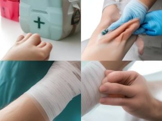 被动物咬伤后，这样做才能安全无忧